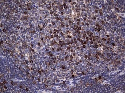 Immunohistochemistry: LYRIC Antibody (1B6) [NBP2-46026] - Analysis of Human lymph node tissue. (Heat-induced epitope retrieval by 1 mM EDTA in 10mM Tris, pH8.5, 120C for 3min)