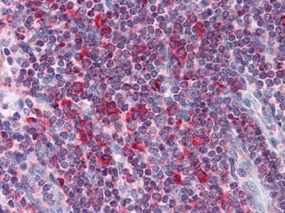 Immunohistochemistry-Paraffin: LYRIC Antibody (2F11C3) [NBP1-51585] - Immunohistochemical analysis of paraffin-embedded human Liver tissues using Metadherin mouse mAb