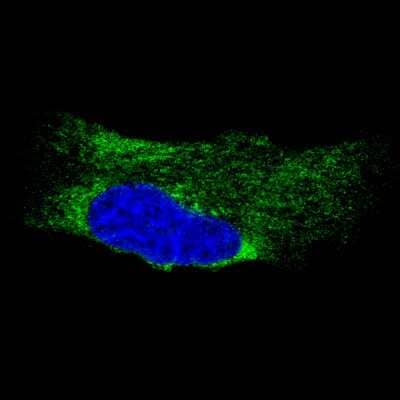 Immunocytochemistry/Immunofluorescence: LYRIC Antibody (CL0397) [NBP2-52929] - Staining of U-251 cells using the Anti-MTDH monoclonal antibody, showing specific staining in the endoplasmic reticulum in green. Microtubule- and nuclear probes are visualized in red and blue, respectively (where available).