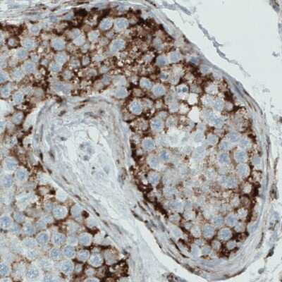 Immunohistochemistry-Paraffin: LYRIC Antibody (CL0397) [NBP2-52929] - Staining of human testis shows strong cytoplasmic positivity in seminiferous tubules.