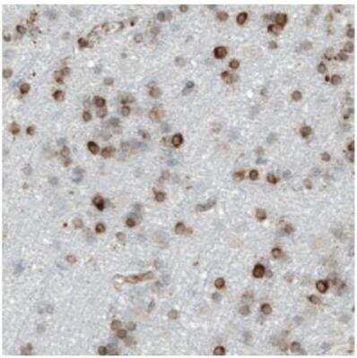 Immunohistochemistry-Paraffin: LYRIC Antibody (CL0401) [NBP2-30458] - Staining of human cerebral cortex shows moderate to strong cytoplasmic positivity in glial cells.