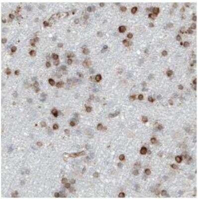 Immunohistochemistry-Paraffin: LYRIC Antibody (CL0401) [NBP2-30458] - Staining of human cerebral cortex shows moderate to strong cytoplasmic positivity in glial cells.