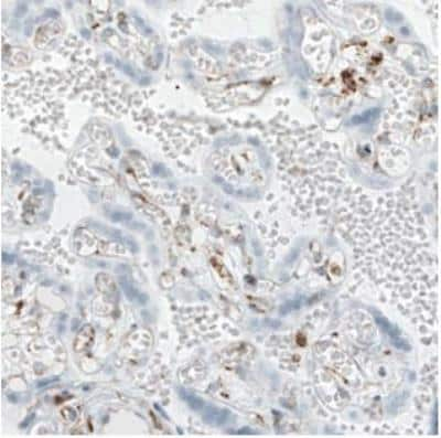 Immunohistochemistry-Paraffin: LYRIC Antibody (CL0401) [NBP2-30458] - Staining of human placenta shows absence of staining in the trophoblast layer (negative control).