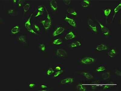 Immunocytochemistry/Immunofluorescence: LYRIC Antibody [H00092140-D01P] - Analysis of antibody to MTDH on HeLa cell. Antibody concentration 10 ug/ml.