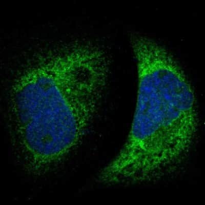 Immunocytochemistry/Immunofluorescence: LYRIC Antibody [NBP1-90328] - Immunofluorescent staining of human cell line A-431 shows localization to endoplasmic reticulum.