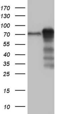 Western Blot: LYRIC Antibody (OTI1B6) - Azide and BSA Free [NBP2-72552] - Analysis of HEK293T cells were transfected with the pCMV6-ENTRY control (Left lane) or pCMV6-ENTRY LYRIC.