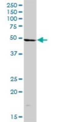 Western Blot: LYRIC Antibody [H00092140-B01P] - Analysis of MTDH expression in human placenta.