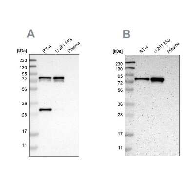 Western Blot Metadherin Antibody - BSA Free