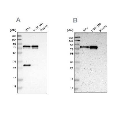 Western Blot: LYRIC Antibody [NBP1-90327] - Analysis using Anti-MTDH antibody NBP1-90327 (A) shows similar pattern to independent antibody NBP1-90328 (B).