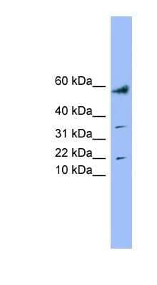 Western Blot: LYRM1 Antibody [NBP1-54901] - Human Placenta lysate, concentration 0.2-1 ug/ml.