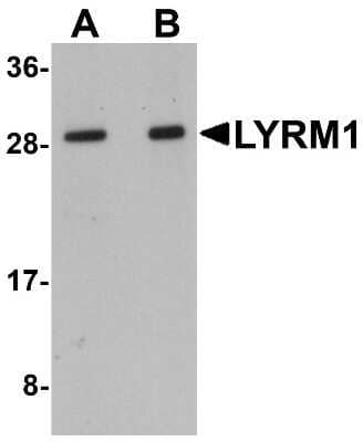 Western Blot: LYRM1 Antibody [NBP1-77136] - Human liver tissue lysate with LYRM1 antibody at (A) 1 and (B) 2 ug/mL.