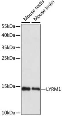 Western Blot: LYRM1 Antibody [NBP3-04423] - Analysis of extracts of various cell lines, using LYRM1 antibody at 1:1000 dilution. Secondary antibody: HRP Goat Anti-Rabbit IgG (H+L) at 1:10000 dilution. Lysates/proteins: 25ug per lane. Blocking buffer: 3% nonfat dry milk in TBST. Detection: ECL Basic Kit