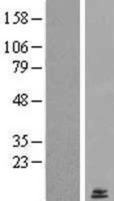 Western Blot: LYRM2 Overexpression Lysate (Adult Normal) [NBL1-12765] Left-Empty vector transfected control cell lysate (HEK293 cell lysate); Right -Over-expression Lysate for LYRM2.