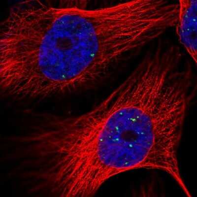 Immunocytochemistry/Immunofluorescence: LYRM4 Antibody [NBP1-86762] - Staining of human cell line U-251 MG shows localization to nuclear bodies. Antibody staining is shown in green.