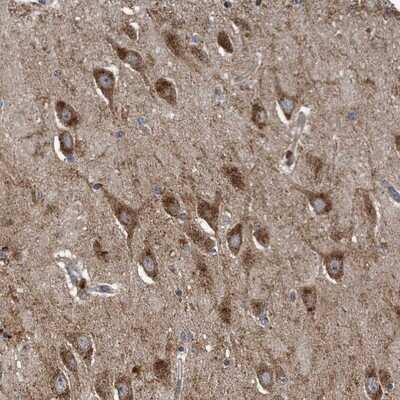 Immunohistochemistry-Paraffin: LYRM4 Antibody [NBP1-86762] - Staining of human hippocampus shows strong cytoplasmic positivity in neuronal cells.