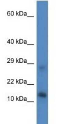 Western Blot LYRM4 Antibody