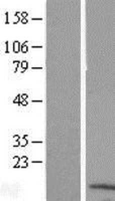 Western Blot: LYRM4 Overexpression Lysate (Adult Normal) [NBL1-12766] Left-Empty vector transfected control cell lysate (HEK293 cell lysate); Right -Over-expression Lysate for LYRM4.