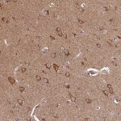 Immunohistochemistry-Paraffin: LYRM7 Antibody [NBP2-14701] - Staining of human Cerebral cortex shows moderate granular cytoplasmic positivity in neuronal cells.