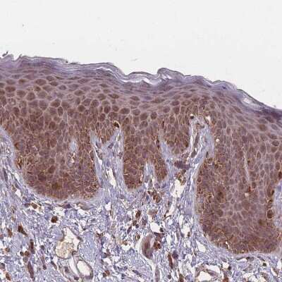 Immunohistochemistry-Paraffin: LYRM7 Antibody [NBP2-14701] - Staining of human Skin shows moderate granular cytoplasmic positivity in squamous epithelial cells.