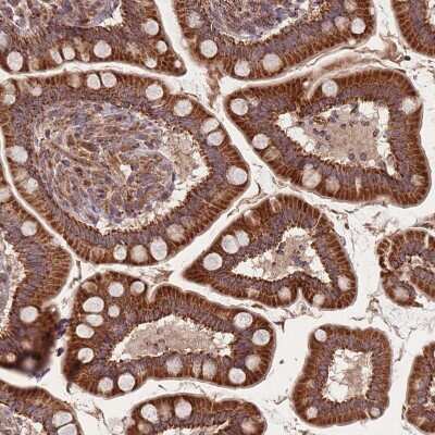 Immunohistochemistry-Paraffin: LYRM7 Antibody [NBP2-14701] - Staining of human Small intestine shows moderate granular cytoplasmic positivity in glandular cells.