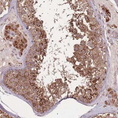 Immunohistochemistry-Paraffin: LYRM7 Antibody [NBP2-14701] - Staining of human Testis shows strong granular cytoplasmic positivity in cells in seminiferous ducts and Leydig cells.