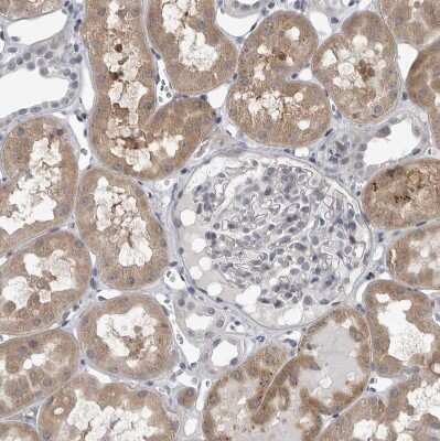 Immunohistochemistry-Paraffin: LYSMD1 Antibody [NBP1-81095] - Staining of human kidney shows moderate cytoplasmic positivity in cells in tubules.
