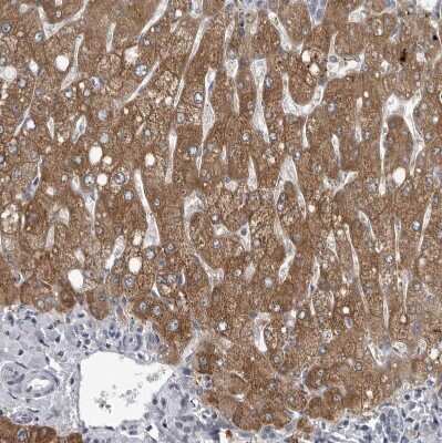 Immunohistochemistry-Paraffin: LYSMD1 Antibody [NBP1-81095] - Staining of human liver shows moderate cytoplasmic positivity in hepatocytes.