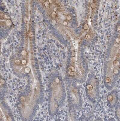 Immunohistochemistry-Paraffin: LYSMD1 Antibody [NBP1-81095] - Staining of human upper dodenum shows weak cytoplasmic positivity in glandular cells.