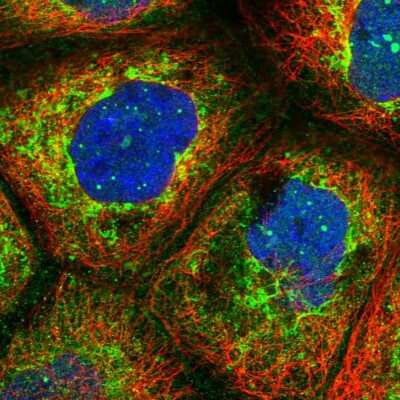 Immunocytochemistry/ Immunofluorescence LYSMD2 Antibody - BSA Free