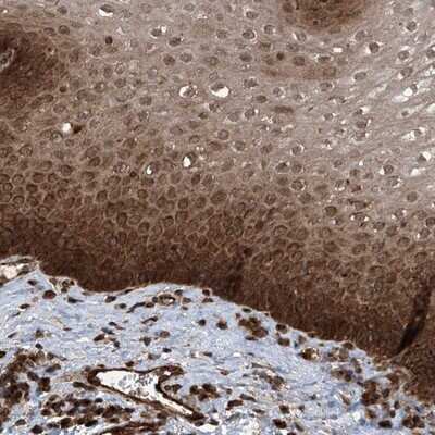 Immunohistochemistry-Paraffin: LYSMD4 Antibody [NBP1-83511] - Staining of human esophagus shows strong cytoplasmic and nuclear positivity in squamous epithelial cells.
