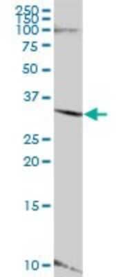 Western Blot: LYSMD4 Antibody [H00145748-B01P] - Analysis of LYSMD4 expression in human kidney.