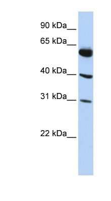 Western Blot: LYSMD4 Antibody [NBP1-62190] - Titration: 0.2-1 ug/ml, Positive Control: HepG2 cell lysate.
