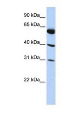 Western Blot: LYSMD4 Antibody [NBP1-69234] - This Anti-LYSMD4 antibody was used in Western Blot of HepG2     tissue lysate at a concentration of 1ug/ml.