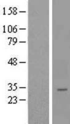 Western Blot: LYSMD4 Overexpression Lysate (Adult Normal) [NBL1-12769] Left-Empty vector transfected control cell lysate (HEK293 cell lysate); Right -Over-expression Lysate for LYSMD4.