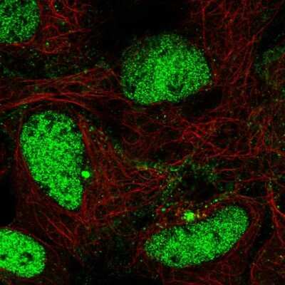 Immunocytochemistry/Immunofluorescence: LYST Antibody [NBP2-56533] - Staining of human cell line HEK 293 shows localization to nucleoplasm & microtubule organizing center. Antibody staining is shown in green.
