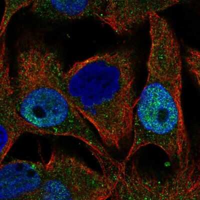 Immunocytochemistry/Immunofluorescence: LZIC Antibody [NBP2-57065] - Staining of human cell line SK-MEL-30 shows localization to nucleoplasm & cytosol.