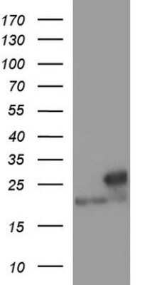 Western Blot: LZIC Antibody (OTI3A7) - Azide and BSA Free [NBP2-72559] - Analysis of HEK293T cells were transfected with the pCMV6-ENTRY control (Left lane) or pCMV6-ENTRY LZIC.