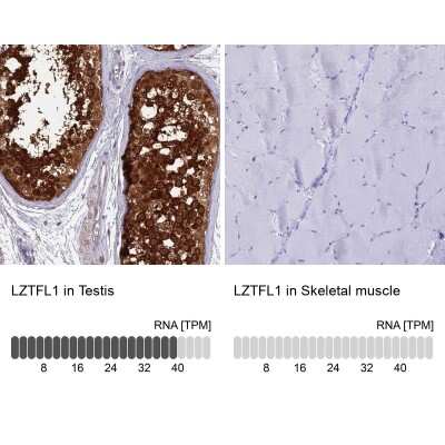 Immunohistochemistry-Paraffin: LZTFL1 Antibody [NBP2-47387] - Staining in human testis and skeletal muscle tissues using anti-LZTFL1 antibody. Corresponding LZTFL1 RNA-seq data are presented for the same tissues.