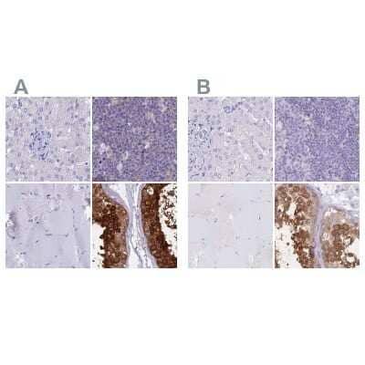 Immunohistochemistry-Paraffin: LZTFL1 Antibody [NBP2-47387] - Staining of human liver, lymph node, skeletal muscle and testis using Anti-LZTFL1 antibody NBP2-47387 (A) shows similar protein distribution across tissues to independent antibody NBP2-30690 (B).