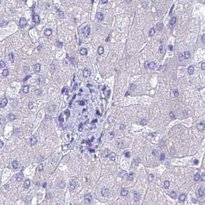 Immunohistochemistry-Paraffin: LZTFL1 Antibody [NBP2-47387] - Staining of human liver.