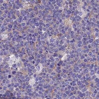 Immunohistochemistry-Paraffin: LZTFL1 Antibody [NBP2-47387] - Staining of human lymph node.