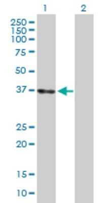 Western Blot: LZTFL1 Antibody [H00054585-D01P] - Analysis of LZTFL1 expression in transfected 293T cell line by LZTFL1 polyclonal antibody.Lane 1: LZTFL1 transfected lysate(34.60 KDa).Lane 2: Non-transfected lysate.