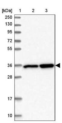 Western Blot: LZTFL1 Antibody [NBP2-47387] - Lane 1: Marker  [kDa] 250, 130, 95, 72, 55, 36, 28, 17, 10.  Lane 2: Human cell line RT-4.  Lane 3: Human cell line U-251MG.