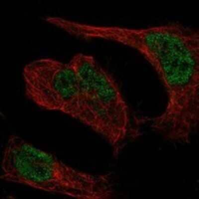Immunocytochemistry/Immunofluorescence: LZTR1 Antibody [NBP3-17734] - Staining of human cell line HeLa shows localization to nucleoplasm.