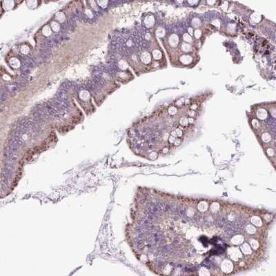 Immunohistochemistry: LZTR1 Antibody [NBP2-49567] - Staining of human small intestine shows granular positivity in glandular cells.