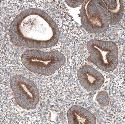 Immunohistochemistry-Paraffin: LZTR1 Antibody [NBP2-49649] - Staining of human endometrium shows moderate granular cytoplasmic positivity in glandular cells.