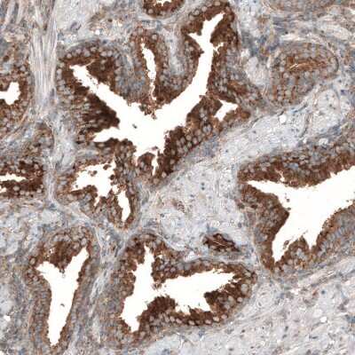 Immunohistochemistry-Paraffin: LZTR1 Antibody [NBP2-49649] - Staining of human prostate shows strong granular cytoplasmic positivity in glandular cells.