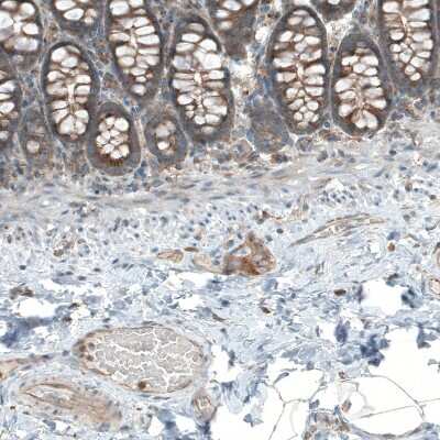 Immunohistochemistry-Paraffin: LZTR1 Antibody [NBP2-49649] - Staining of human rectum shows moderate granular cytoplasmic positivity in peripheral nerve / ganglion and glandular cells.
