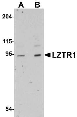 Western Blot LZTR1 Antibody - BSA Free