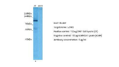 Western Blot: LZTR1 Antibody [NBP2-87761] - Host: Rabbit. Target: LZTR1. Positive control (+): 293T Cell Lysate (2T). Negative control (-): A549 Cell Lysate (N03). Antibody concentration: 5ug/ml